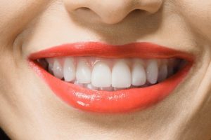 Read more about the article Cómo blanquear los dientes de forma natural